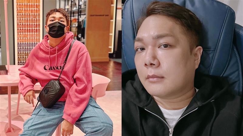 做正顎遭評戽斗較好看　關韶文深夜發聲了