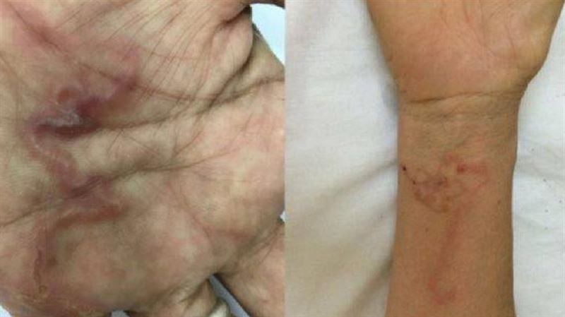 寄生蟲鑽腦築巢　竟是愛吃「這一味」惹禍
