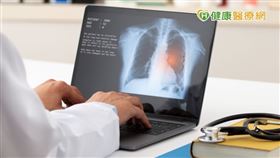 由於小細胞肺癌腫瘤生長快速，擴散期患者不適合做放射治療，洪仁宇醫師表示，主要治療方式為化學治療，若病人體力可負擔，一線治療時會將2種化療藥物組合使用，70-80%患者的腫瘤可有效縮小。