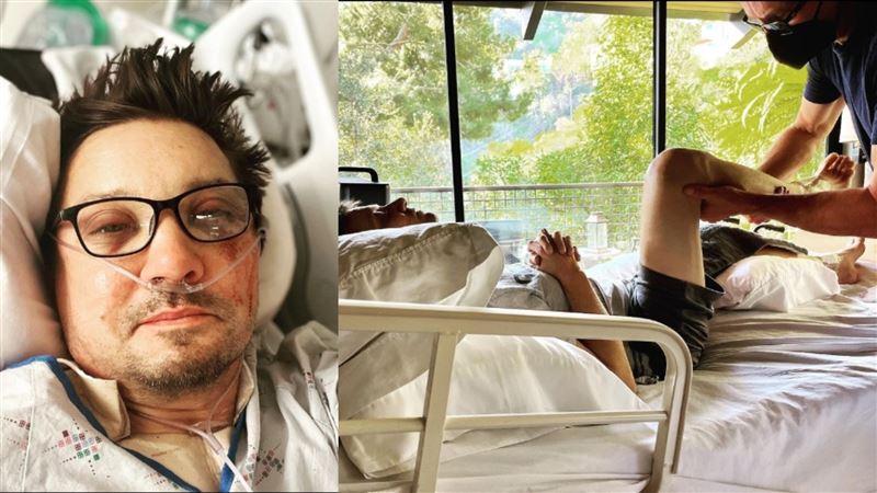30根骨頭斷裂！鷹眼重傷3個月首公開現身