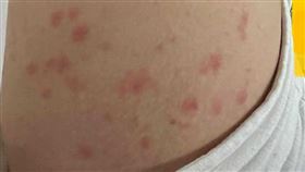 （圖／翻攝自臉書／《皮膚科日常菡養　高珮菡醫師》）