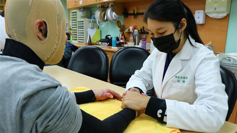 40%燒傷「外觀劇變」她復健1年多走出陰霾