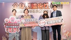 （左起）台灣皮膚科醫學會黃毓惠醫師、台灣皮膚科醫學會趙曉秋理事長、全身型膿疱性乾癬病友李小姐、台北林口長庚醫院皮膚部陳俊賓醫師。