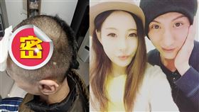 周永恒傷勢曝光怵目驚心。（圖／翻攝自因葵臉書）