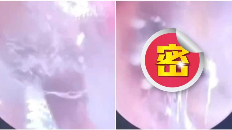 聽力下降「蜘蛛作祟」　盤絲洞畫面公開
