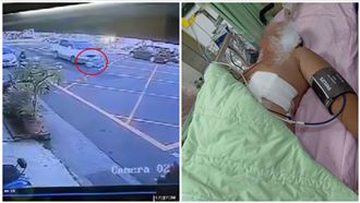 童國小前過馬路遭撞輾「胎痕布臉」進加護