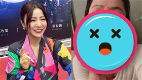 丁噹燙傷臉和手！認「非常的嚴重」　曝最新傷勢：出乎了我的意料。（圖／翻攝自丁噹IG）