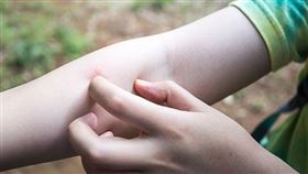 小黑蚊,止癢,冰敷。(圖/翻攝自基督教門諾會醫院)