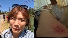 小象愛出門,小象,斯里蘭卡,車禍,醫院