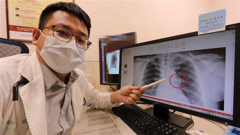 他喉嚨沙啞、背痛　一查「腰椎骨被吃掉」