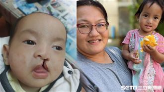唇腭裂嬰險變孤兒　嬸嬸暖收養當跨血緣媽