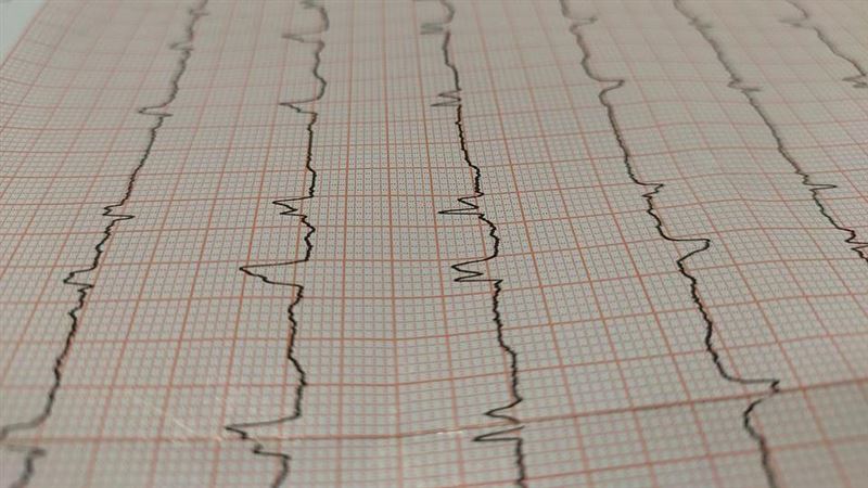 獨／咳嗽1年多好不了　源頭竟是「心」