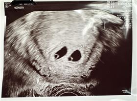 便當夫人　懷孕