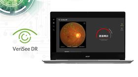 宏碁智醫攜手永信藥品推AI醫材。（圖／永信藥品提供）