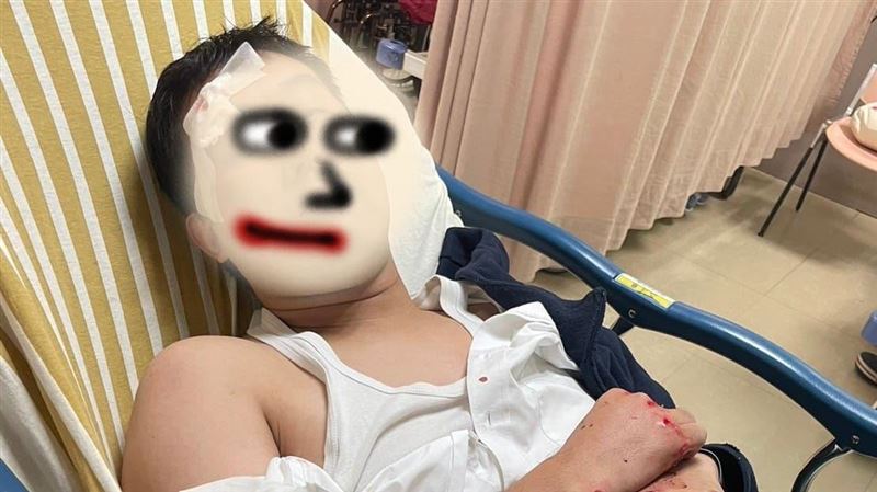 游淑慧貼他受傷照　曝要命的城市障礙賽