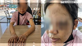 台中惡雇主母女虐外傭　灌水毆打半裸餵食