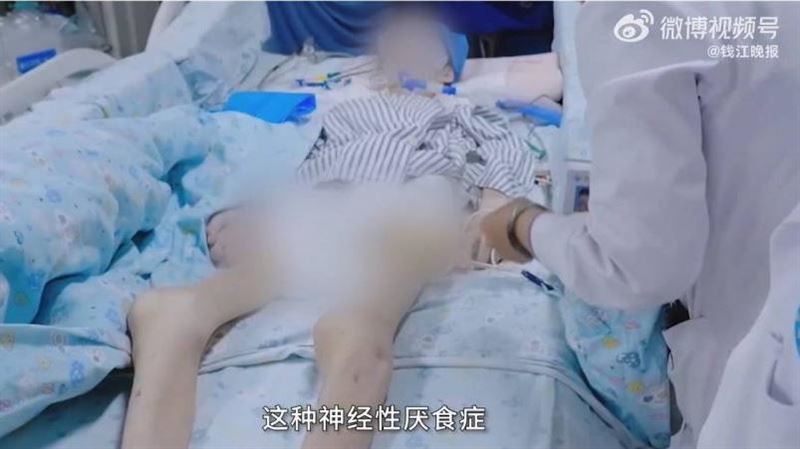 身高165體重不到25　15歲女為愛瘦到死