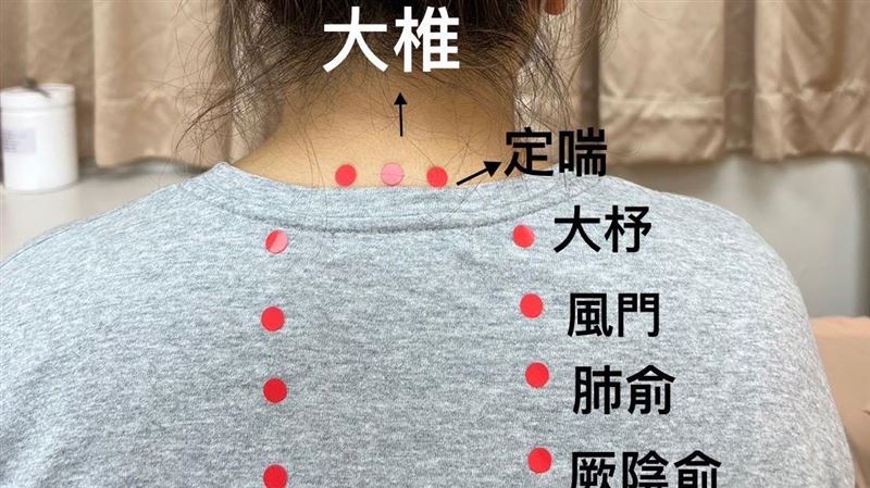 北市４成國小生有鼻過敏　這天來貼三伏貼