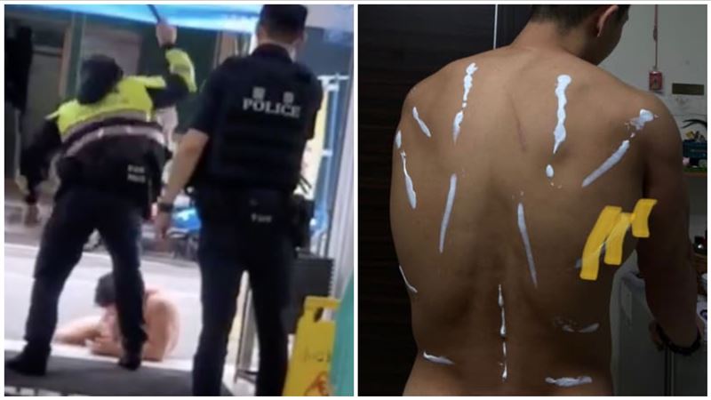 「超商浩克」神隱6天醫院驗傷　背傷曝光