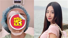 黃紫恩毀容破相眉骨最嚴重，不停滲血足足7個半小時。（組合圖／翻攝自黃紫恩 IG）