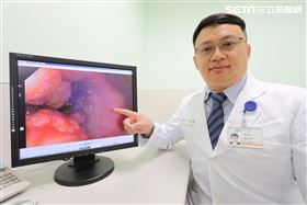 老司機連吞口水都痛！喉嚨7公分被塞滿（圖／翻攝畫面）