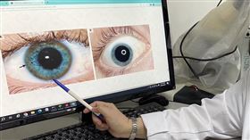 威爾森氏症(茂盛醫院提供)