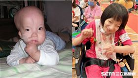 奇蹟女孩小蘋果／受訪者提供