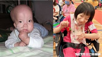 戰勝死神和歧視！「奇蹟女孩」高中畢業了