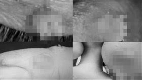 眼睛長菜花,不安全性行為,多重性伴侶,