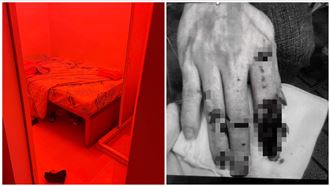 2越女淪私娼拒捕「夾斷警手指」下場曝光