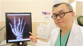 0606手指微創手術接回(亞大醫院提供)