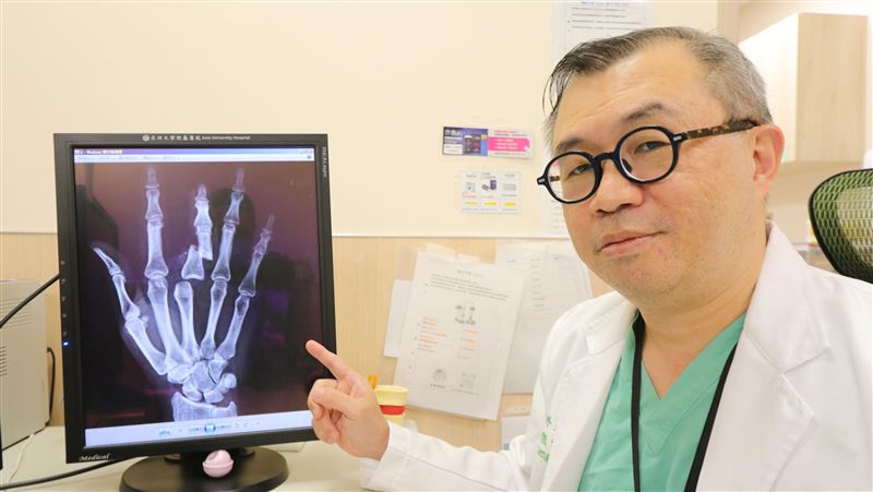 又能緊握小孩手！亞大接血管重建慈母斷指