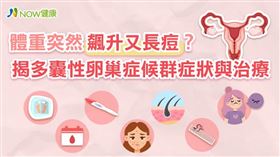 名家專用／月經不規則、突然冒出很多顆痘痘，體重又莫名飆升，小心可能是多囊性卵巢症候群找上你，應及早就醫診治，才能有效改善。（勿用）