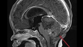 該病童手術前。（圖／北醫附醫提供）