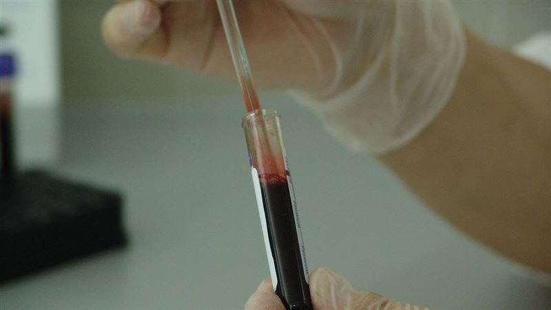 台灣隊研發神奇試劑　1滴血測肺癌復發率
