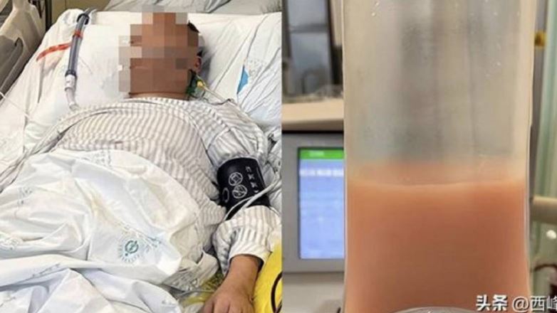 男熬夜喝1飲料引急性胰腺炎！緊急送進ICU