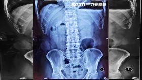 肉粽,端午節,脹氣,高雄,阮綜合