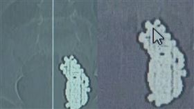 中國,磁力珠,X光,腸胃,異物（圖／翻攝自微博）