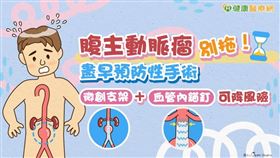 腹主動脈瘤跟一般人所認知的癌症的腫瘤不同，腹動脈瘤是當人的腹主動脈隨著年紀變大退化，直徑逐漸擴大，當擴大到正常血管的1.5倍時，稱之為腹主動脈瘤。