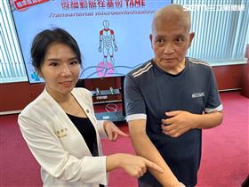 台中榮總,網球肘(中榮提供)
