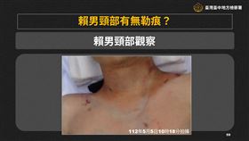  5億高中生，命案，偵結，護頸，勒痕，脖子左後方瘀傷。(圖／中檢提供)