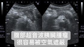 林相宏醫師授權