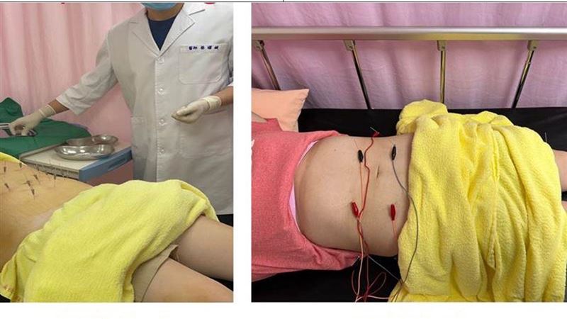 護理師暴食重度肥胖　靠一招甩肉19KG