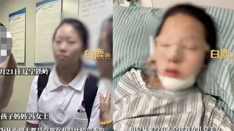 高考後「秒帶女兒整形」　媽：促進她社交