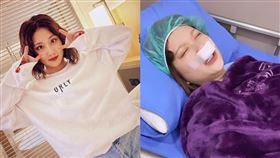 焦凡凡進行「鼻中膈彎曲」手術，還曬出自己術後包紮模樣。（組合圖／翻攝自焦凡凡 IG）