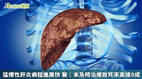 名家專用／猛爆性肝炎病程進展快速，未及時治療致死率高達8成，近日合庫金董事長林謙浩就因猛爆性肝炎突然發作，入院治療仍回天乏術，因此台灣肝病醫療策進會提醒，民眾若出現黃疸症狀，應儘快就醫，以免憾事發生。（勿用）