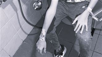 智慧手錶爆炸傷童　新北消保官將這樣做