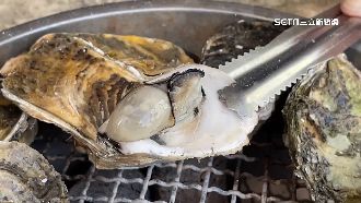 烤蚵被炸傷　男童眼皮、臉頰「掉層皮」