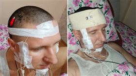 大腦植入晶片「想控制夢境」研究員自己在家手術！慘大失血送醫圖文／CTWANT