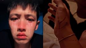 柯震東,愛犬,受傷,大型犬,醫美